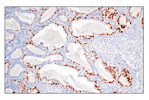 Immunohistochemistry Image 1: Cyclin D1 (E3P5S) XP® Rabbit mAb (BSA and Azide Free)