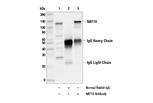Immunoprecipitation Image 1: NAT10 Antibody
