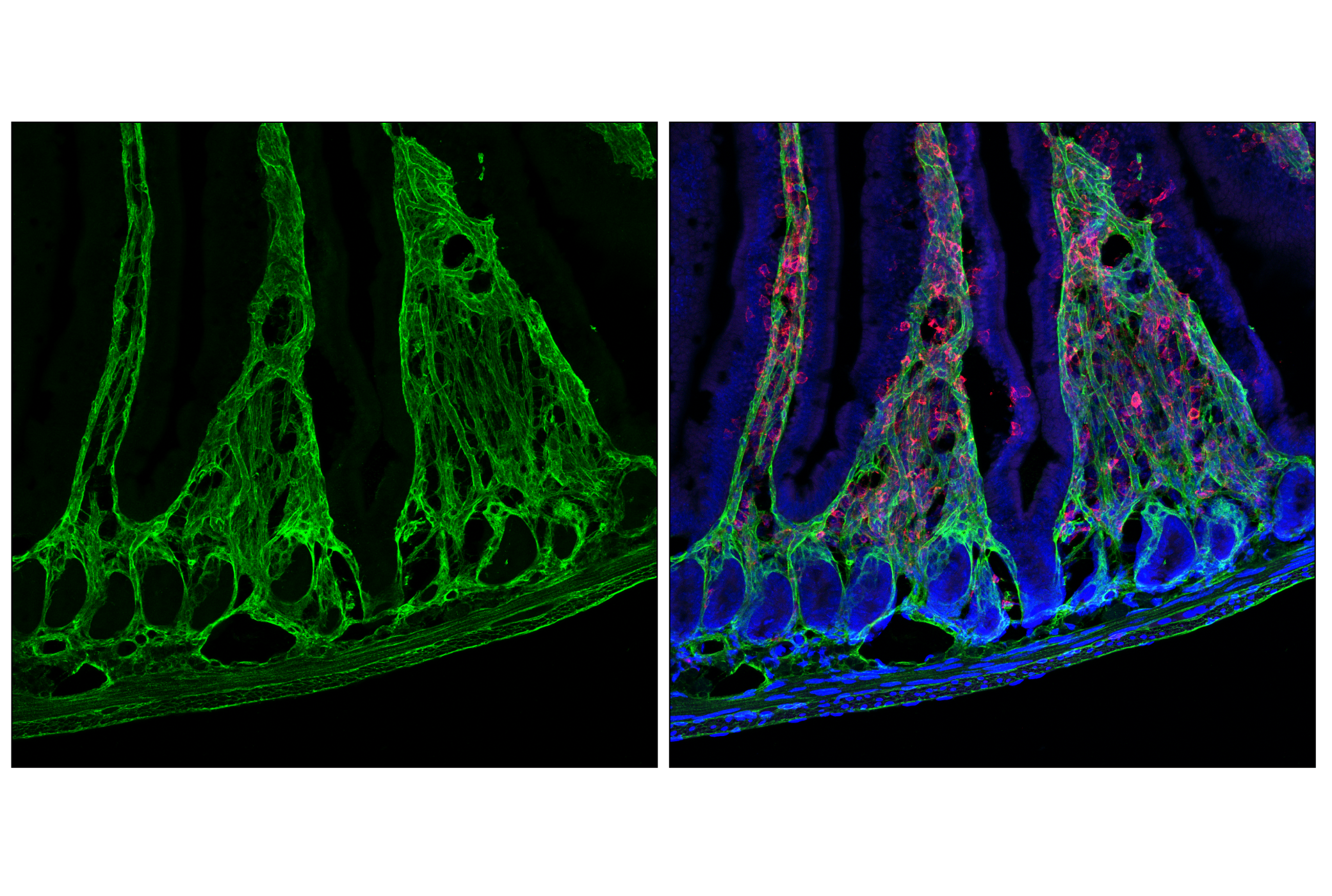 Immunofluorescence Image 1: COL6A1 (E9U3B) Rabbit mAb (BSA and Azide Free)