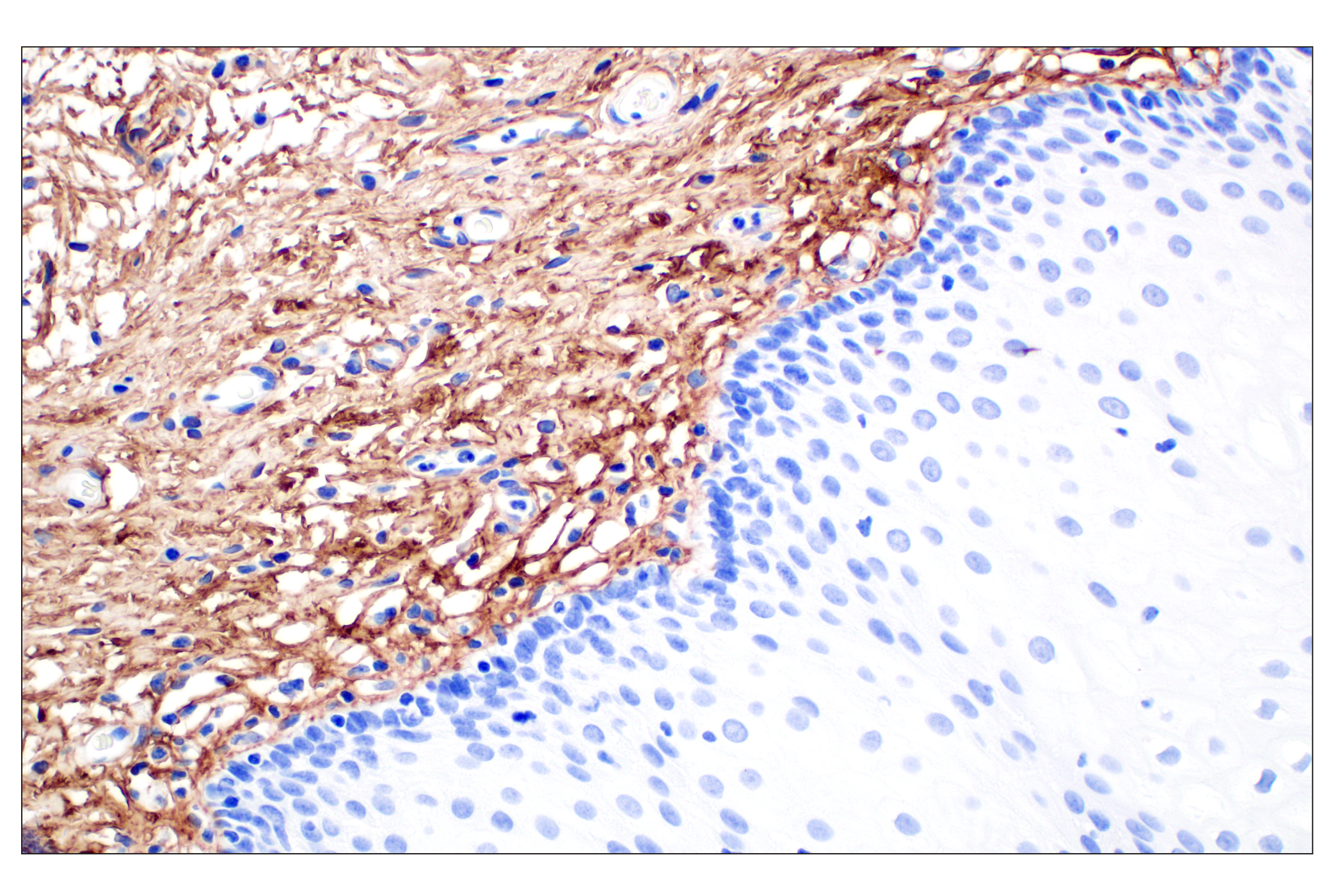 Immunohistochemistry Image 3: COL6A1 (E9U3B) Rabbit mAb (BSA and Azide Free)