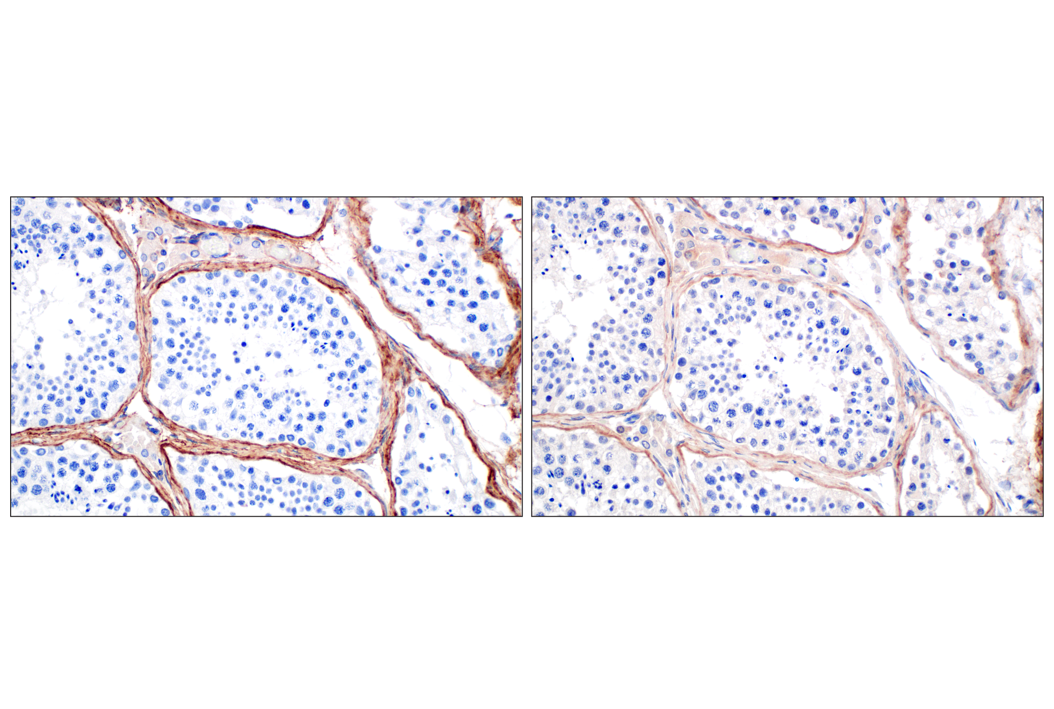 Immunohistochemistry Image 4: COL6A1 (E9U3B) Rabbit mAb (BSA and Azide Free)