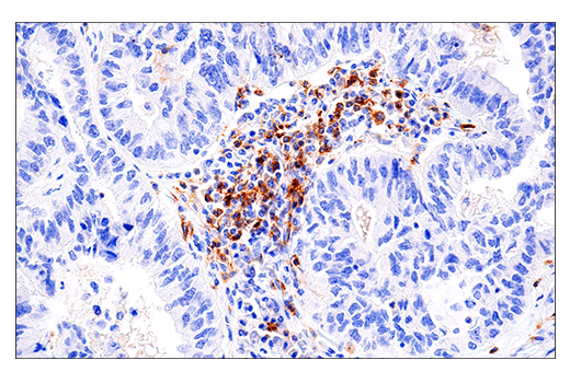 Immunohistochemistry Image 1: DNAM-1/CD226 (E8L9G) XP® Rabbit mAb