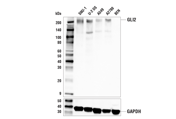 Western Blotting Image 1: GLI2 (E7R1N) Rabbit mAb