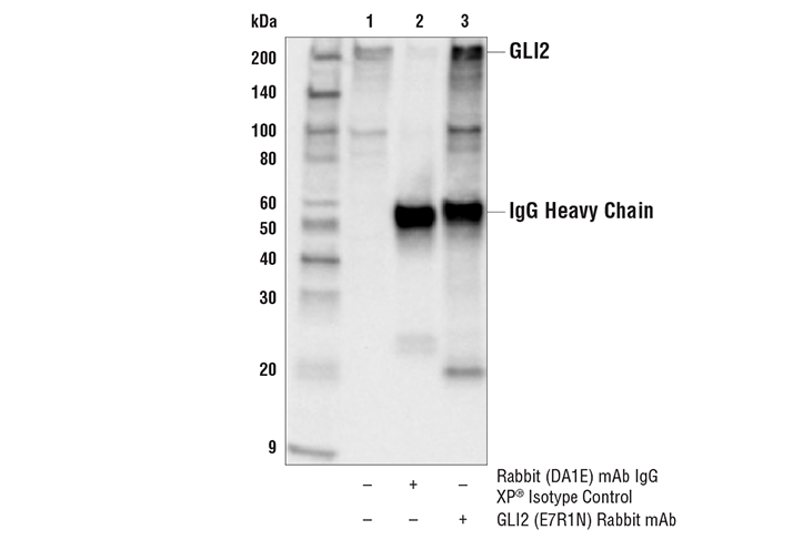 Immunoprecipitation Image 1: GLI2 (E7R1N) Rabbit mAb
