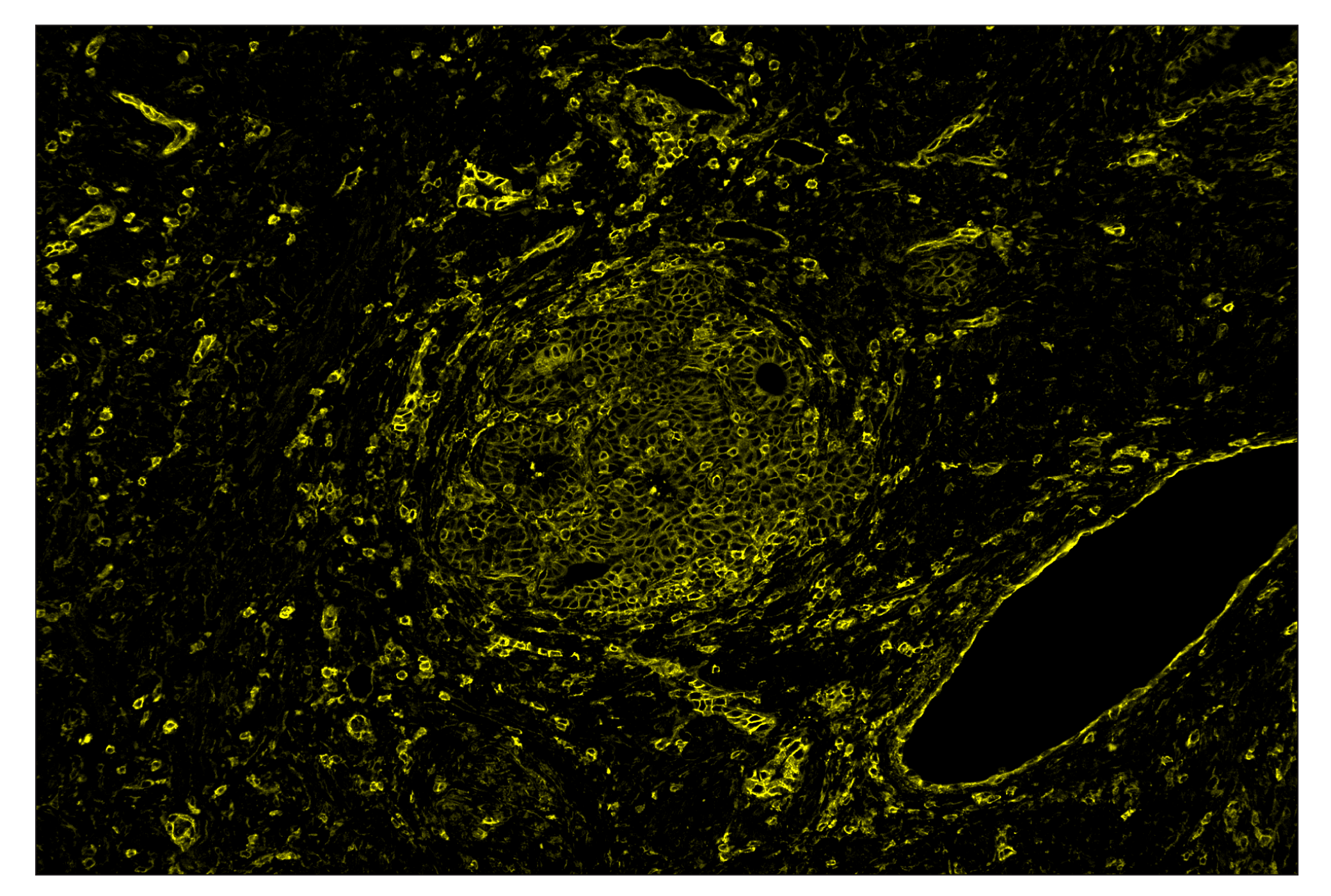 Immunohistochemistry Image 3: MHC Class I (EMR8-5) & CO-0082-488 SignalStar™ Oligo-Antibody Pair