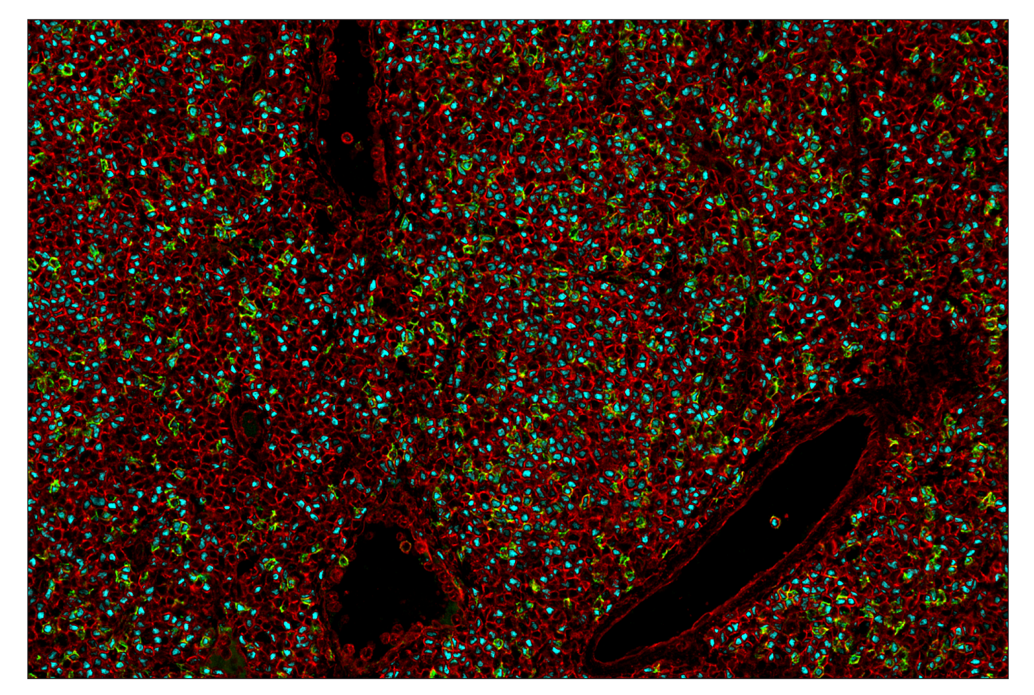 Immunohistochemistry Image 7: MHC Class I (EMR8-5) & CO-0082-594 SignalStar™ Oligo-Antibody Pair