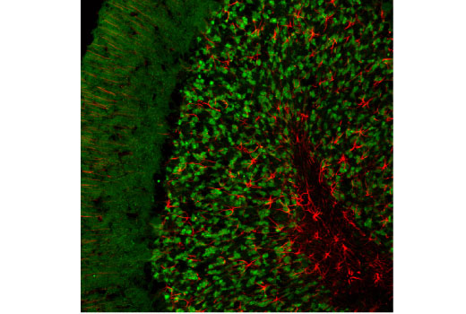 Immunofluorescence Image 1: SV2A (D1L8S) Rabbit mAb