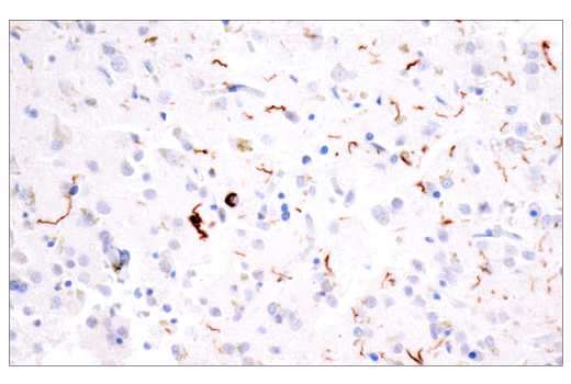 Immunohistochemistry Image 4: Tau (GT-38) Mouse mAb