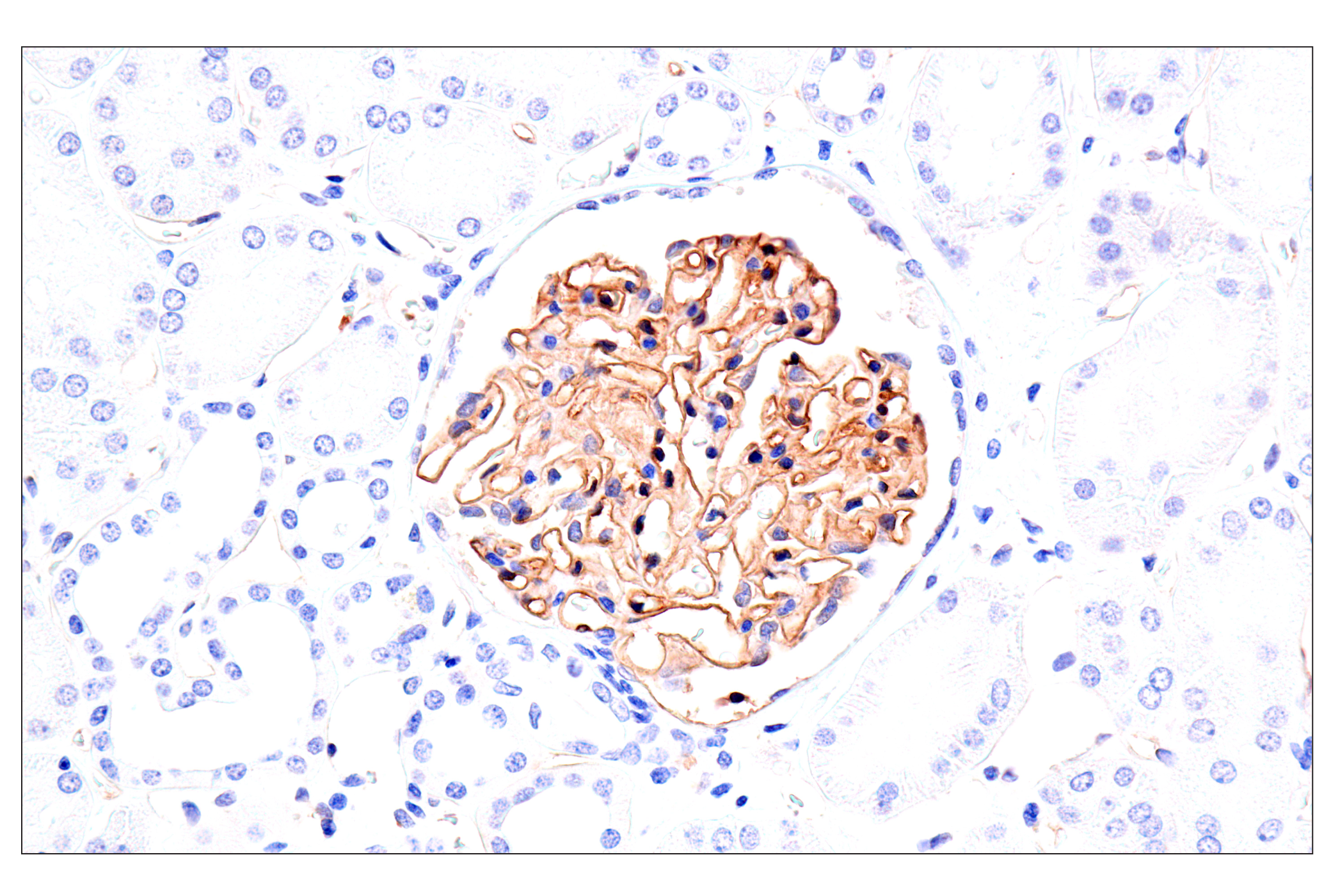 Immunohistochemistry Image 6: Claudin-5 (E5D9Y) Rabbit mAb