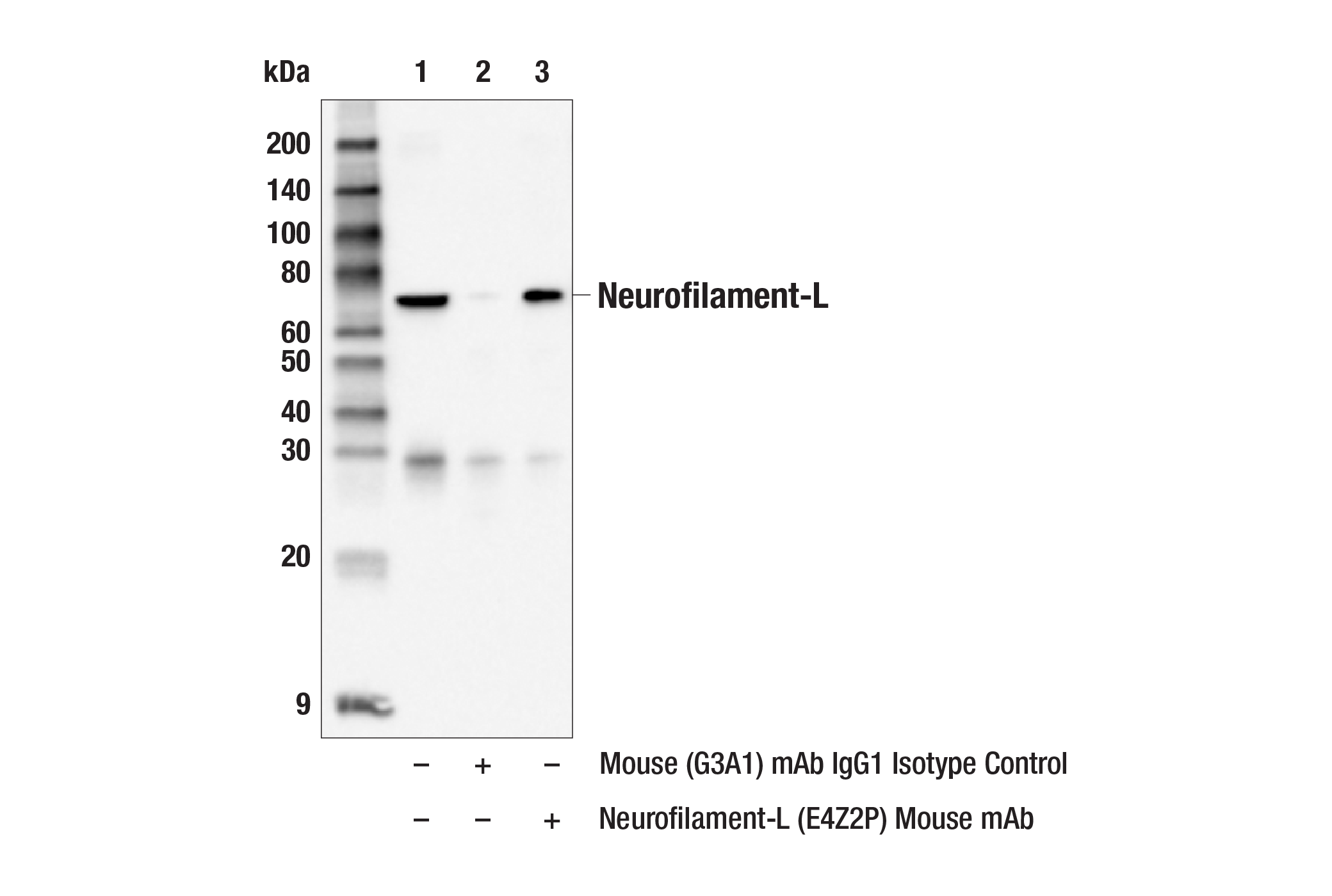 Immunoprecipitation Image 1: Neurofilament-L (E4Z2P) Mouse mAb