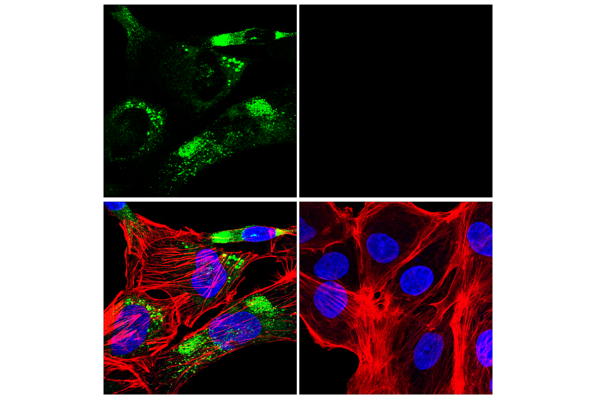 Immunofluorescence Image 1: COL3A1 (E3K9U) Rabbit mAb