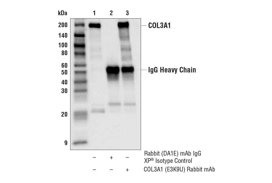 Immunoprecipitation Image 1: COL3A1 (E3K9U) Rabbit mAb