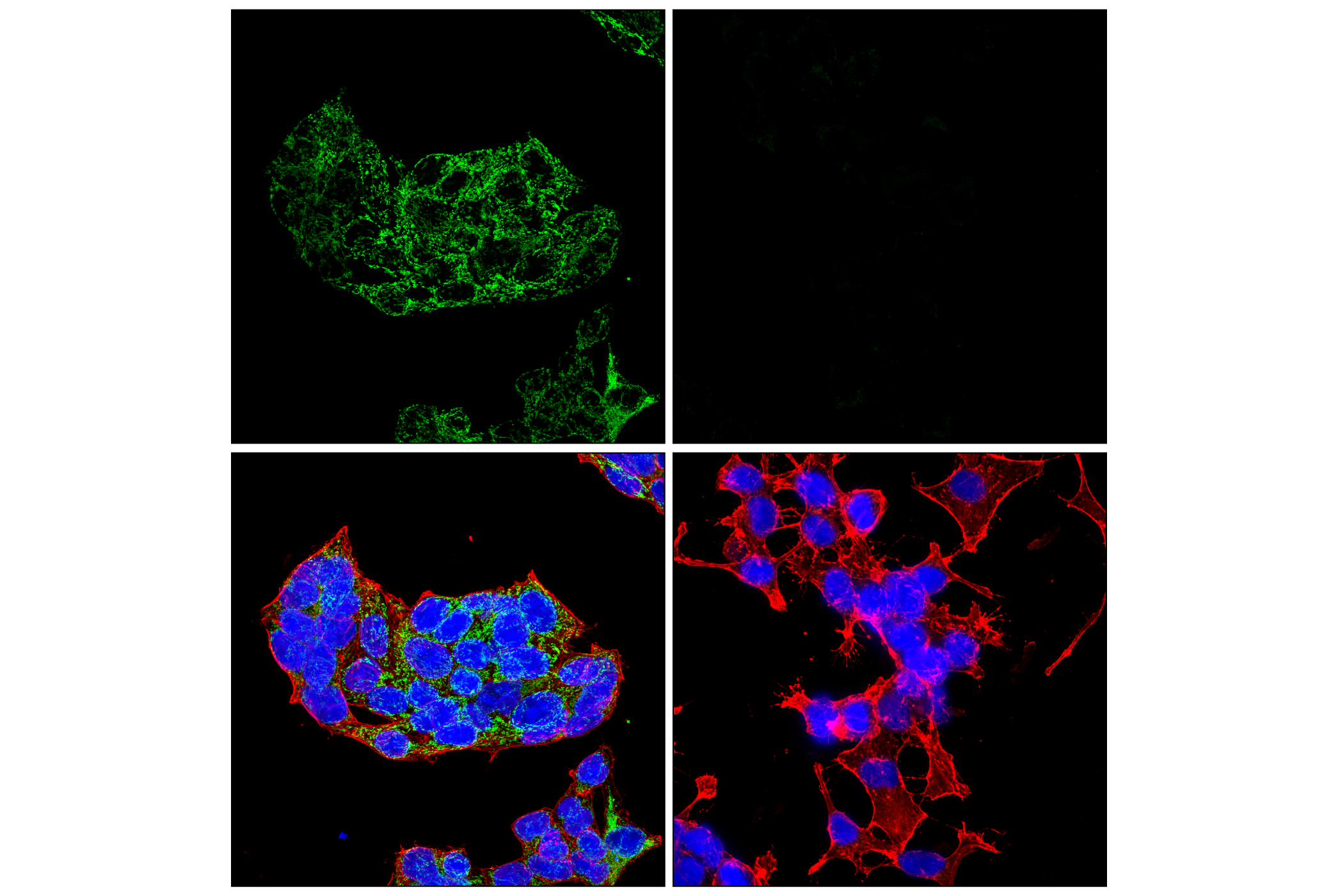 Immunofluorescence Image 1: GOT2 (F4P3R) Rabbit mAb (BSA and Azide Free)