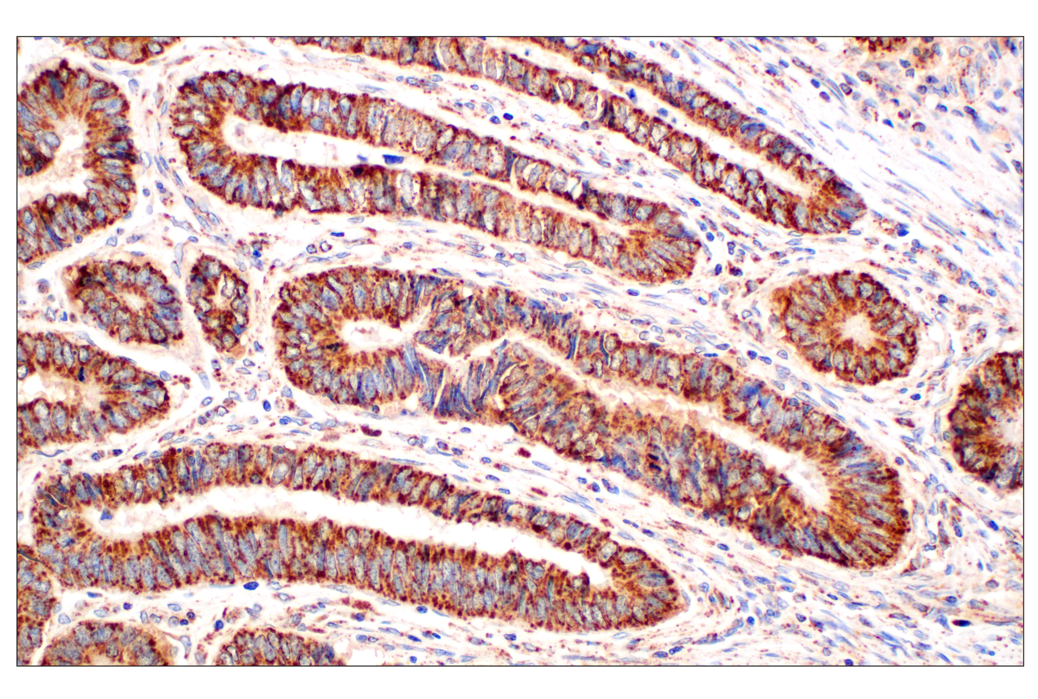 Immunohistochemistry Image 1: GOT2 (F4P3R) Rabbit mAb (BSA and Azide Free)