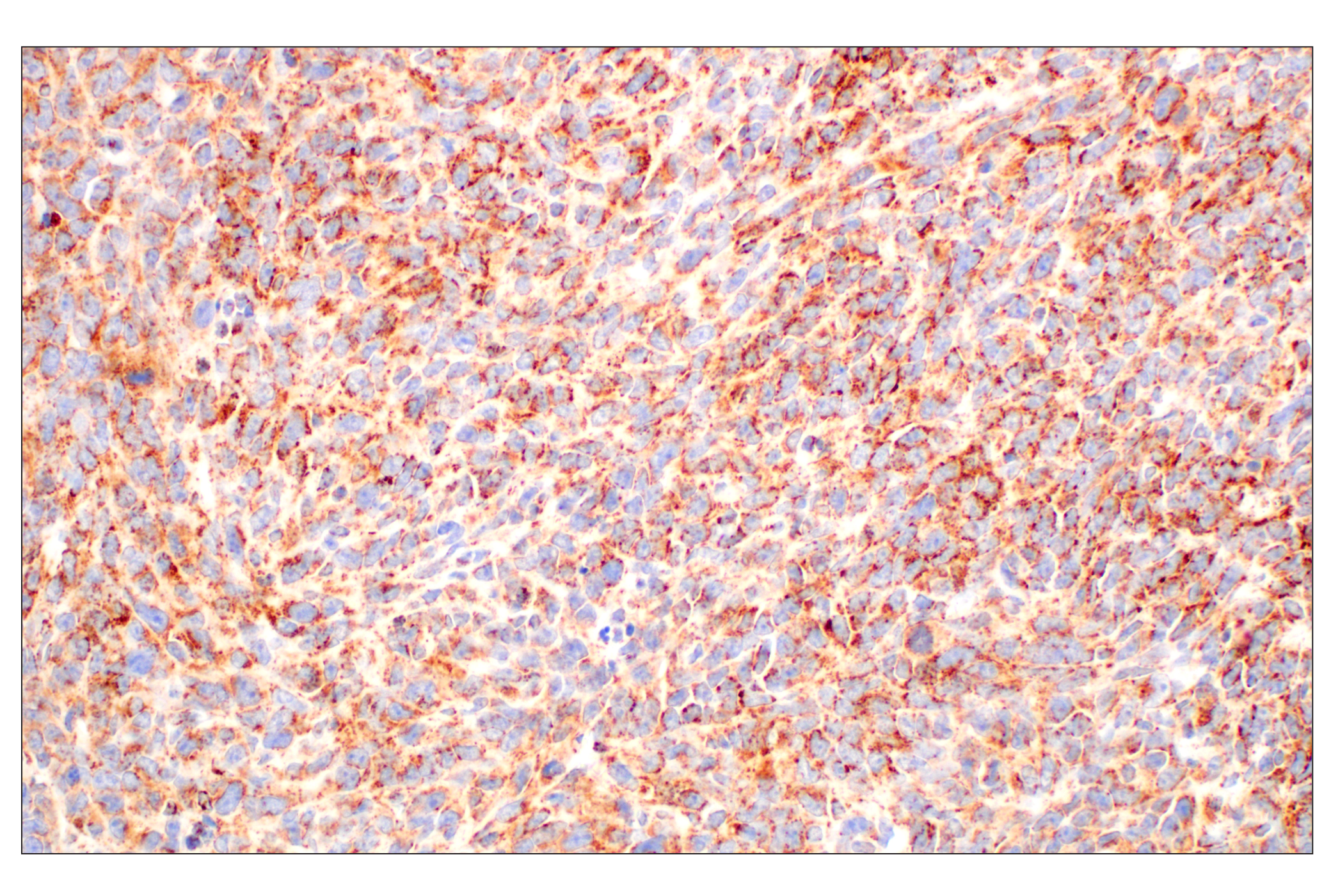 Immunohistochemistry Image 9: GOT2 (F4P3R) Rabbit mAb (BSA and Azide Free)