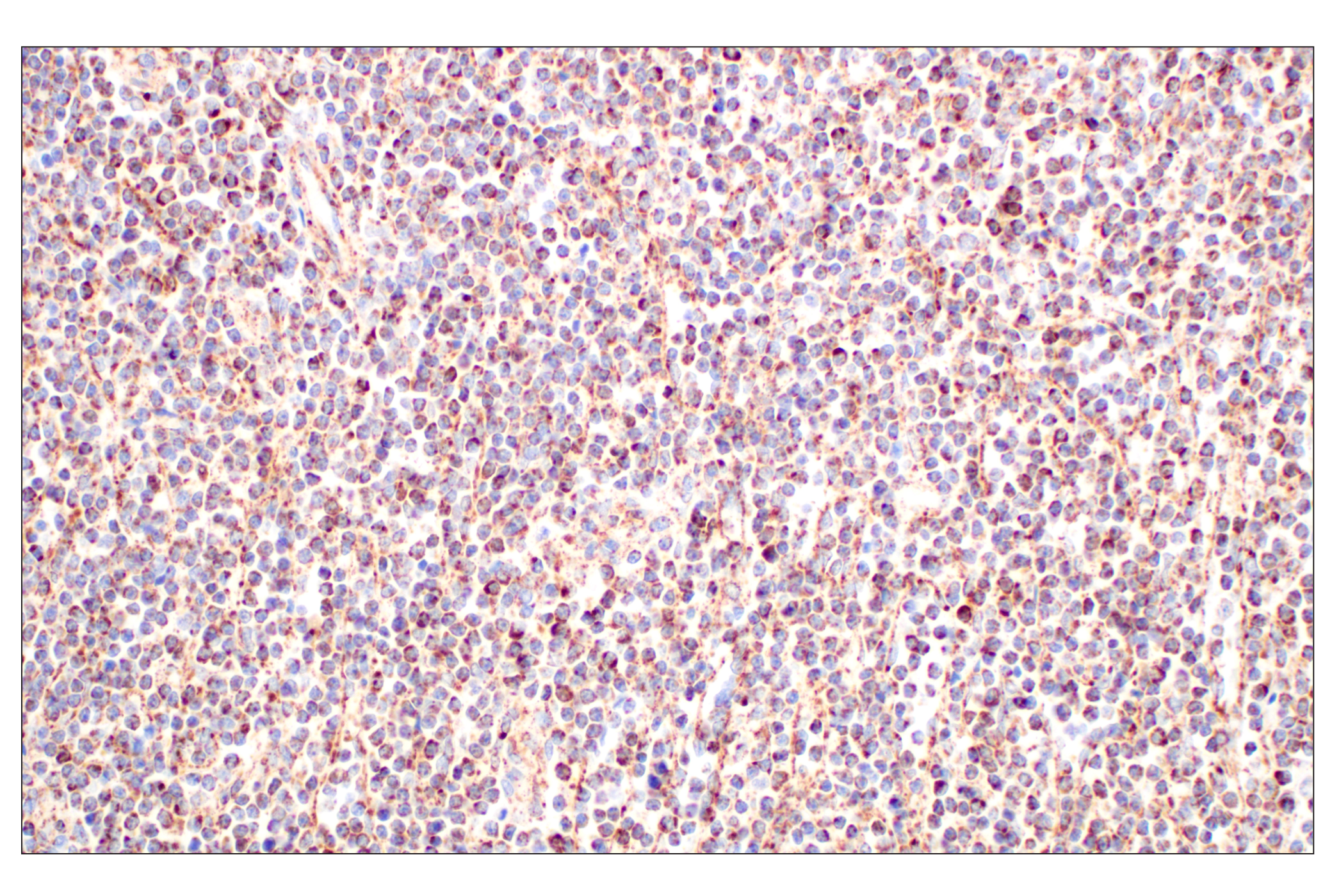 Immunohistochemistry Image 2: GOT2 (F4P3R) Rabbit mAb (BSA and Azide Free)