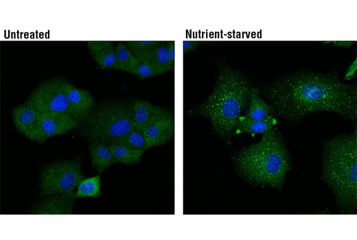 Immunofluorescence Image 1: Atg13 (E1Y9V) Rabbit mAb (BSA and Azide Free)