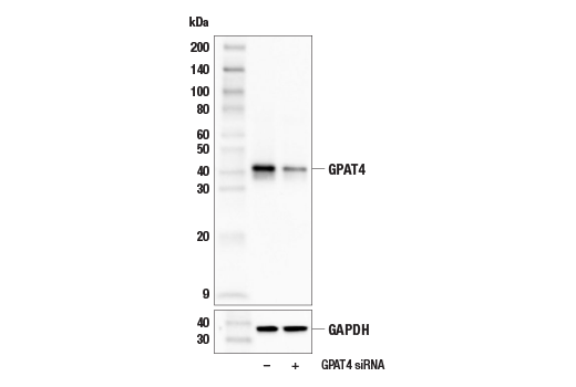 Western Blotting Image 1: GPAT4 Antibody
