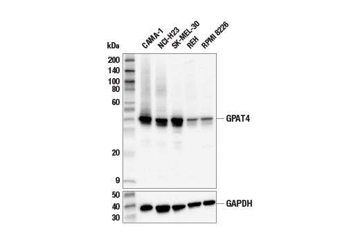 Western Blotting Image 2: GPAT4 Antibody