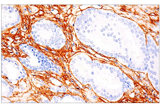 Immunohistochemistry Image 2: COL1A1 (E3E1X) Mouse mAb