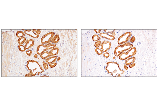 Immunohistochemistry Image 3: IDH1 (RcMab-1) Rat mAb