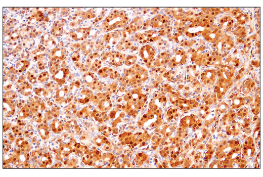 Immunohistochemistry Image 4: IDH1 (RcMab-1) Rat mAb