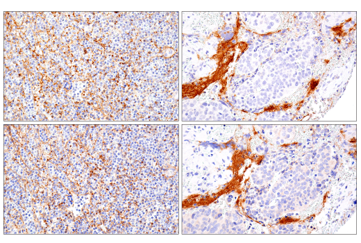 Immunohistochemistry Image 4: DNAM-1/CD226 (E8L9G) XP® Rabbit mAb (BSA and Azide Free)