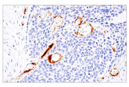 Immunohistochemistry Image 3: DNAM-1/CD226 (E8L9G) XP® Rabbit mAb (BSA and Azide Free)