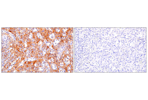 Immunohistochemistry Image 5: DNAM-1/CD226 (E8L9G) XP® Rabbit mAb (BSA and Azide Free)