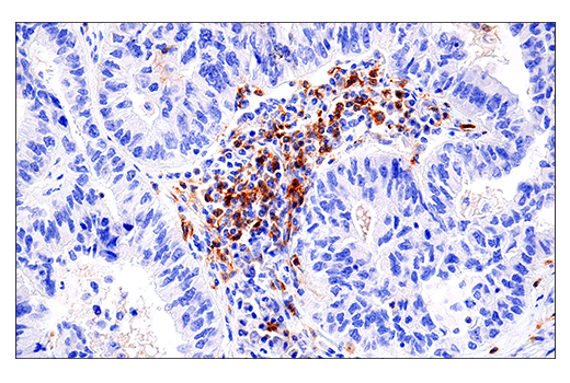 Immunohistochemistry Image 1: DNAM-1/CD226 (E8L9G) XP® Rabbit mAb (BSA and Azide Free)
