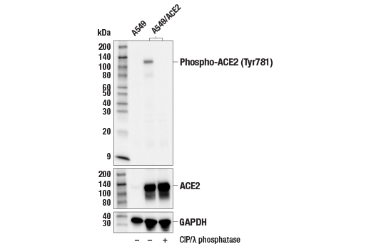 Western Blotting Image 2: Phospho-ACE2 (Tyr781) Antibody