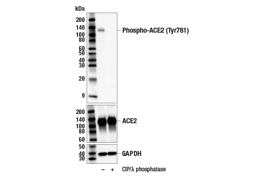 Western Blotting Image 1: Phospho-ACE2 (Tyr781) Antibody