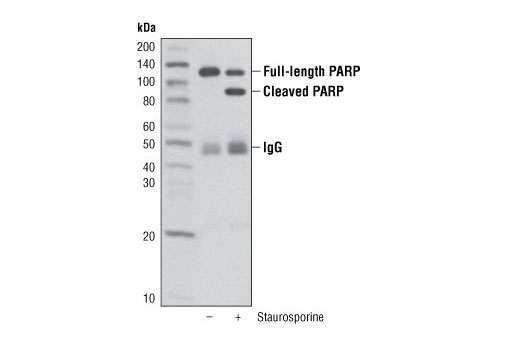 Immunoprecipitation Image 2: PARP (46D11) Rabbit mAb (Sepharose® Bead Conjugate)