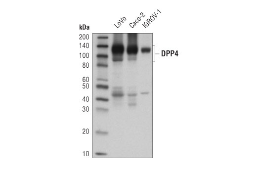  Image 13: Coronavirus Host Cell Attachment and Entry Antibody Sampler Kit
