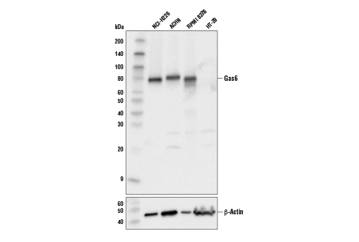  Image 7: Tyro/Axl/Mer Activation Antibody Sampler Kit