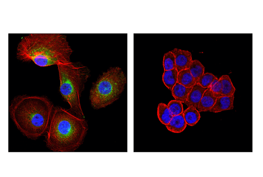 Immunofluorescence Image 1: GAS6 (D3A3G) Rabbit mAb
