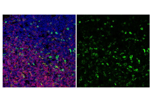 Immunofluorescence Image 1: ICOS (E5F7E) Rabbit mAb