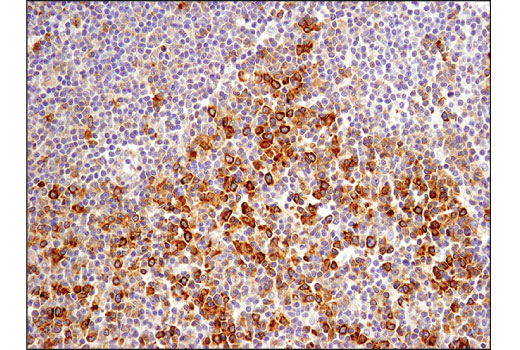 Immunohistochemistry Image 3: Phospho-CAD (Ser1859) (D5K5W) Rabbit mAb