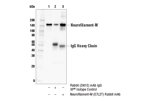 Immunoprecipitation Image 1: Neurofilament-M (E7L2T) Rabbit mAb