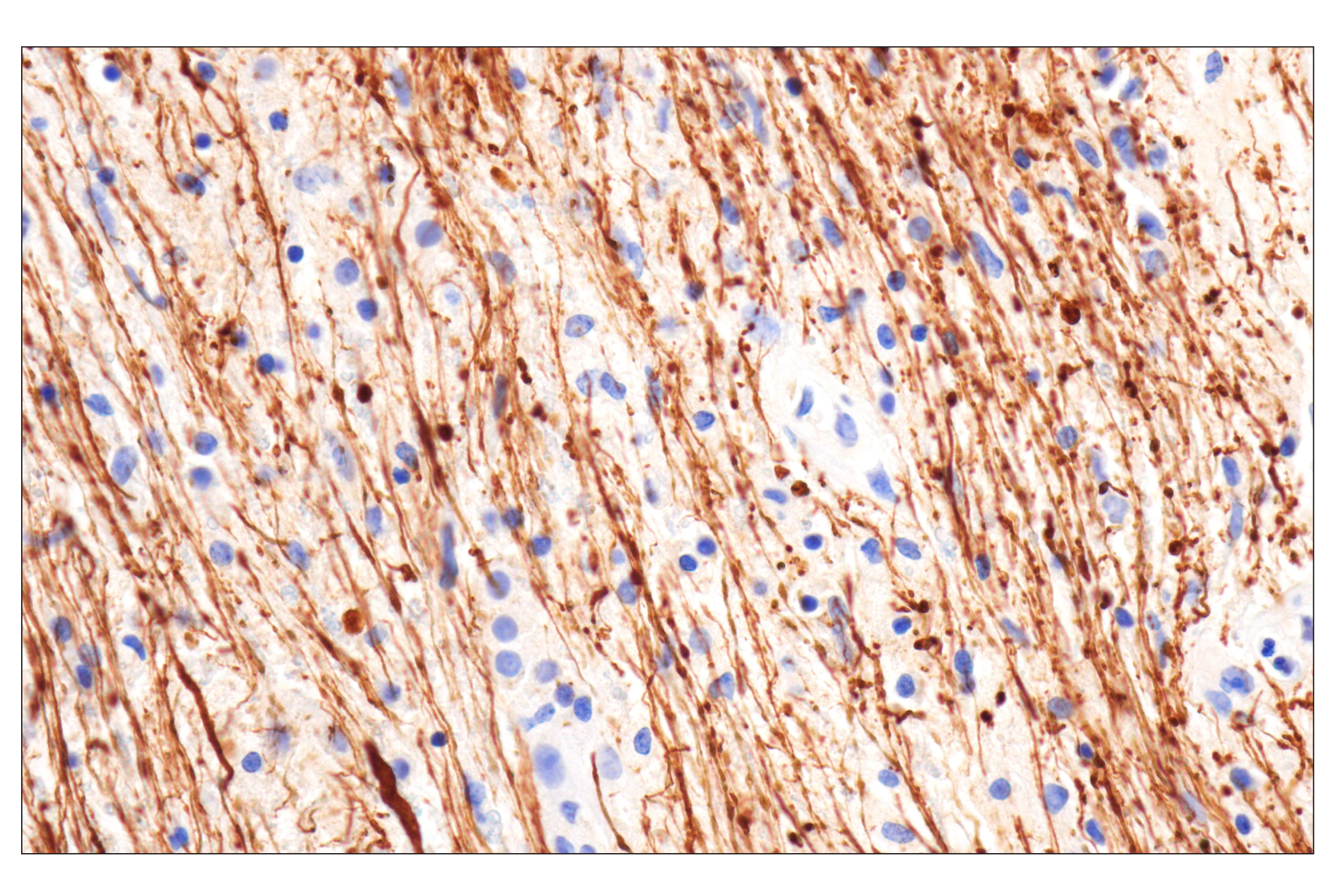 Immunohistochemistry Image 1: Neurofilament-M (E7L2T) Rabbit mAb