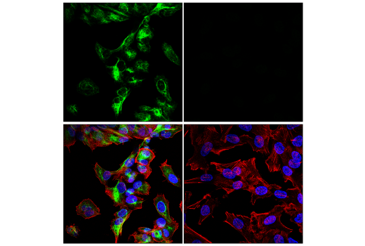 Immunofluorescence Image 3: Neurofilament-M (E7L2T) Rabbit mAb