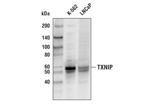 Western Blotting Image 1: TXNIP (D5F3E) Rabbit mAb (Biotinylated)