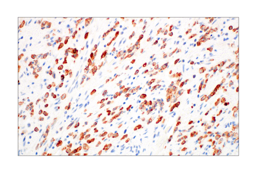 Immunohistochemistry Image 2: Pan-Keratin (AE1/AE3) Mouse mAb