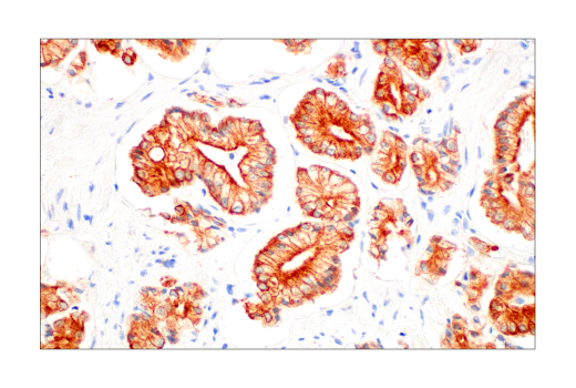 Immunohistochemistry Image 3: Pan-Keratin (AE1/AE3) Mouse mAb