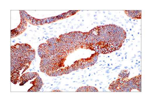 Immunohistochemistry Image 8: Pan-Keratin (AE1/AE3) Mouse mAb