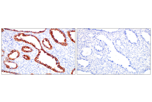 Immunohistochemistry Image 9: Pan-Keratin (AE1/AE3) Mouse mAb