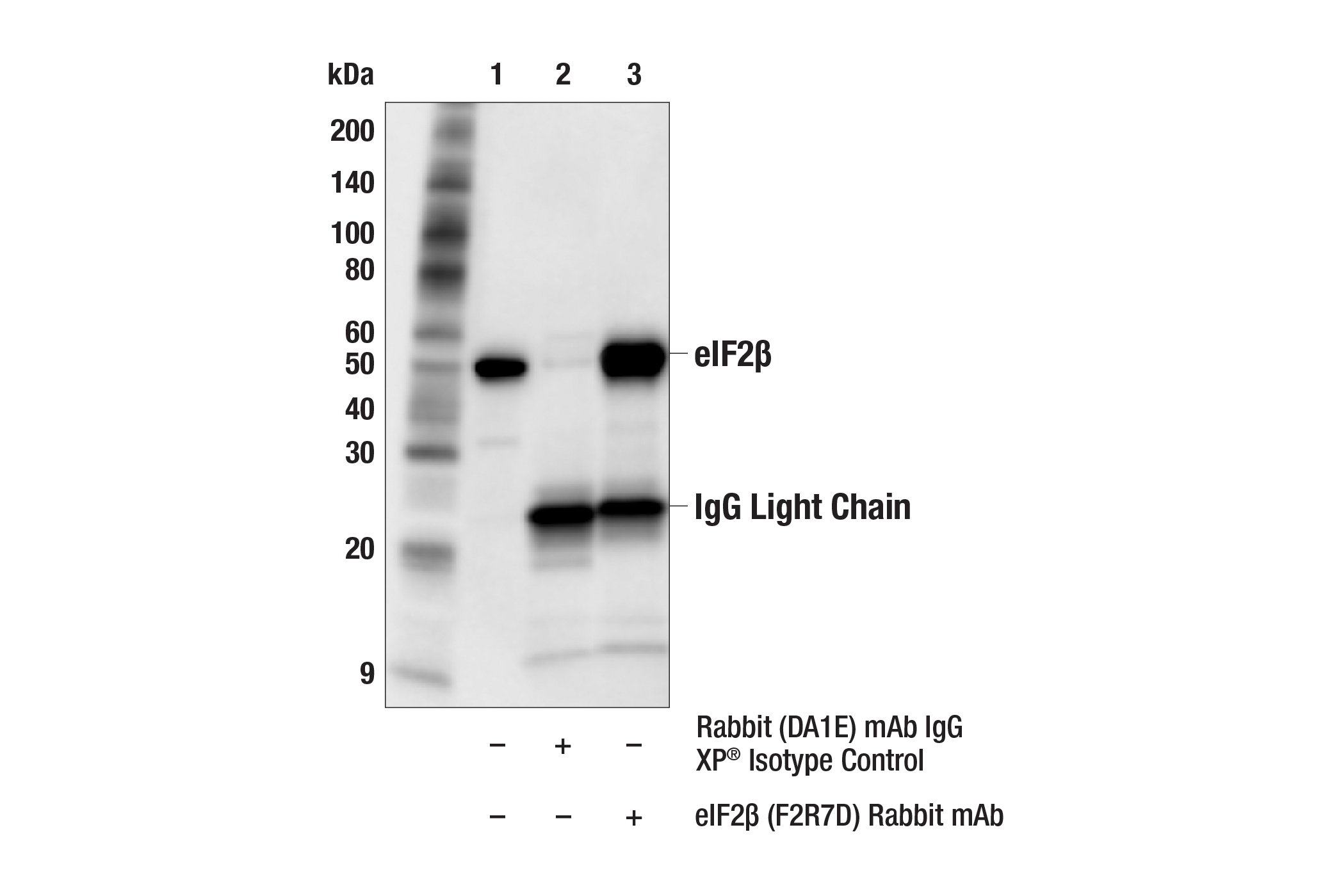 Immunoprecipitation Image 1: eIF2β (F2R7D) Rabbit mAb