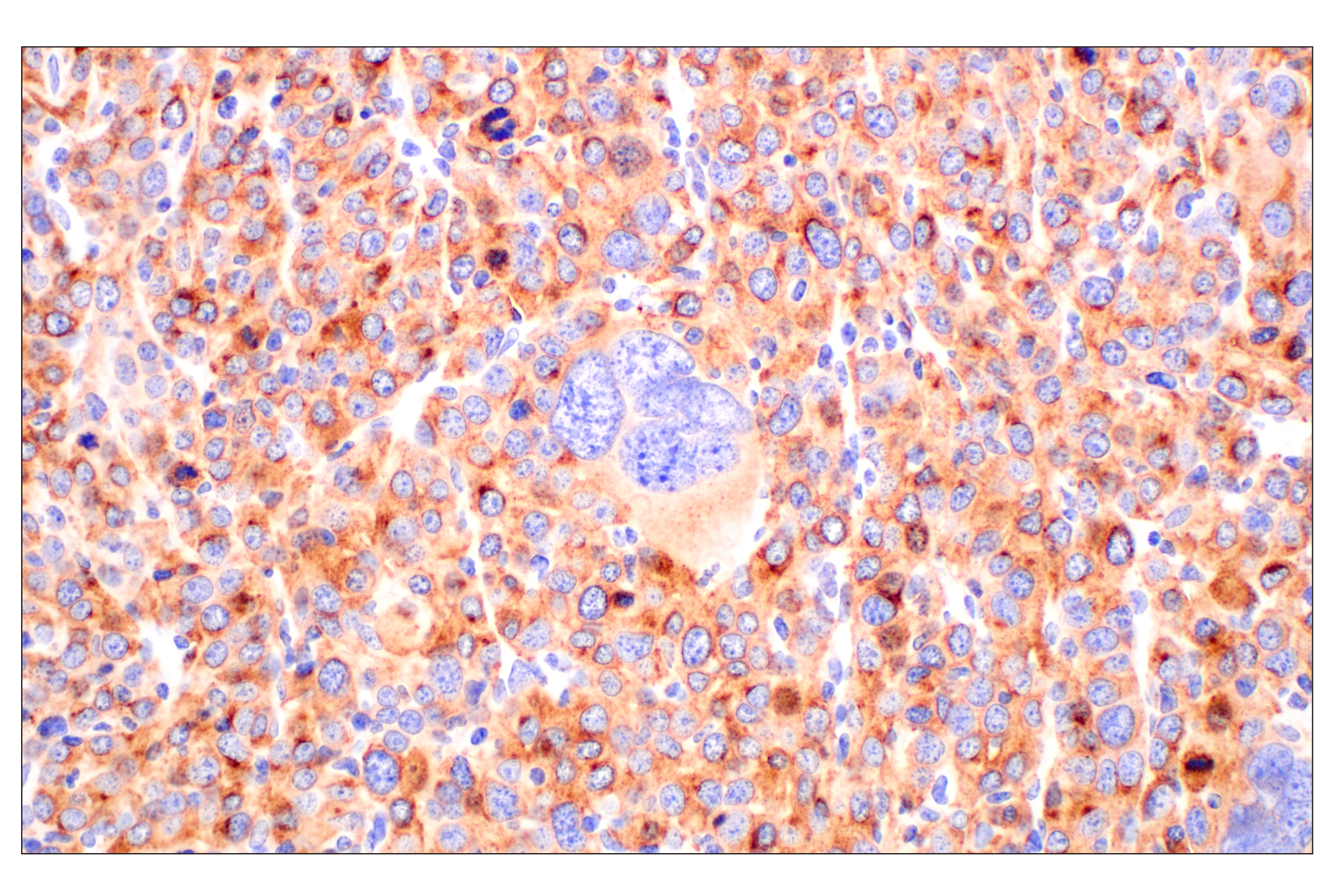 Immunohistochemistry Image 1: CD10/Neprilysin (F4P6H) Rabbit mAb (BSA and Azide Free)