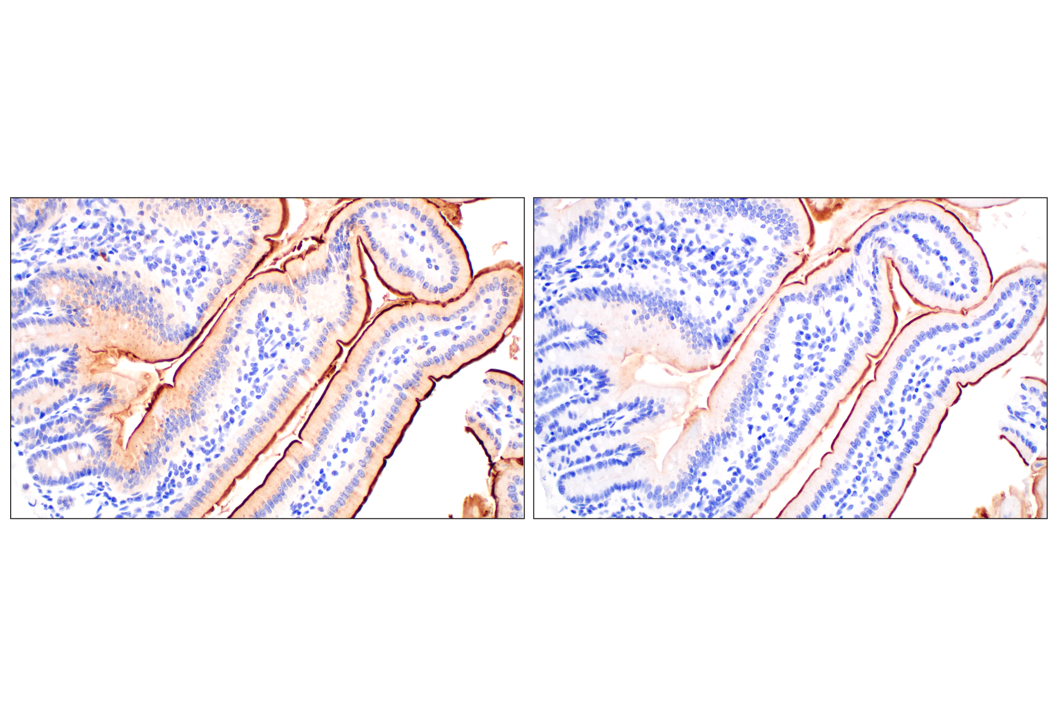 Immunohistochemistry Image 8: CD10/Neprilysin (F4P6H) Rabbit mAb (BSA and Azide Free)
