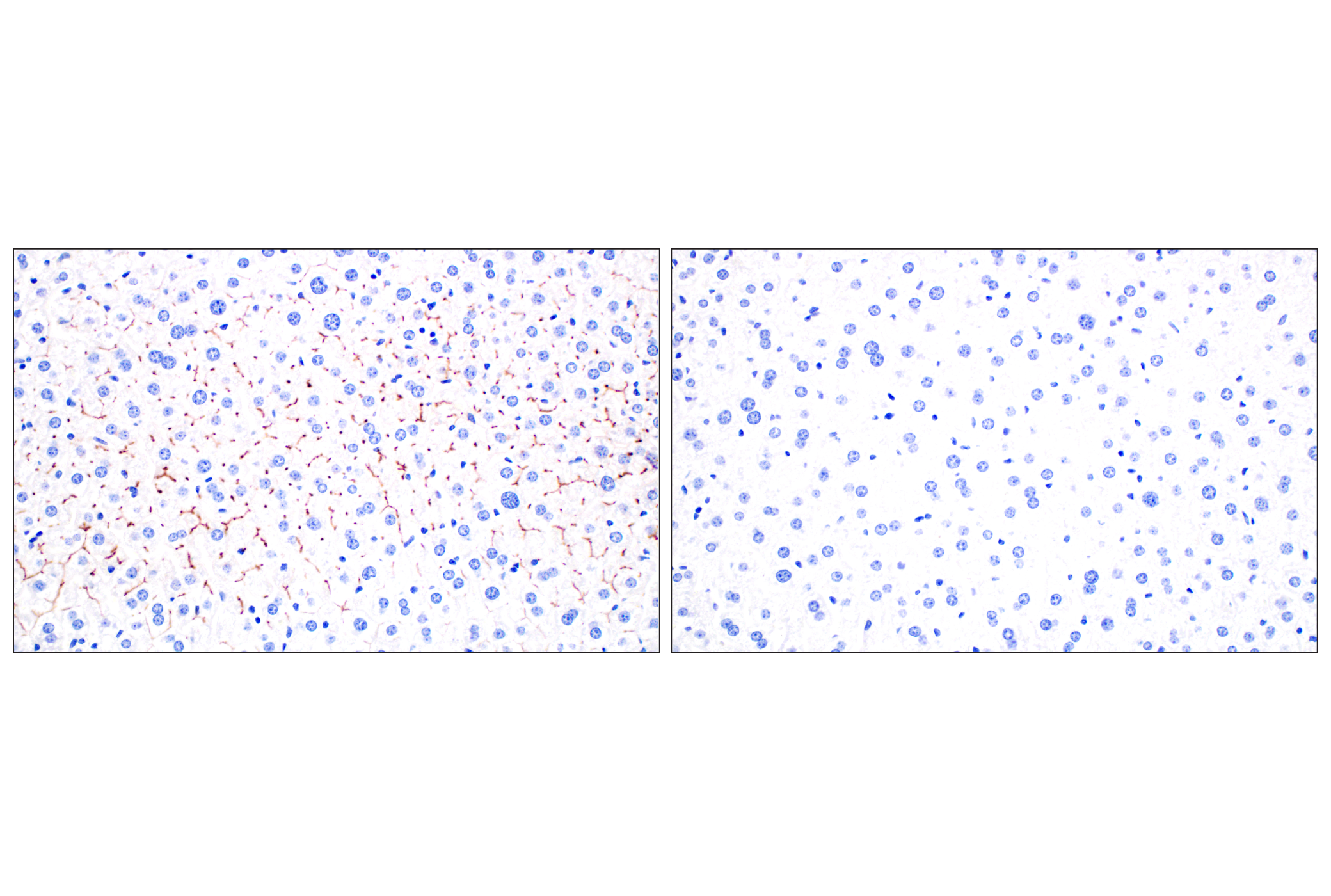 Immunohistochemistry Image 9: CD10/Neprilysin (F4P6H) Rabbit mAb (BSA and Azide Free)